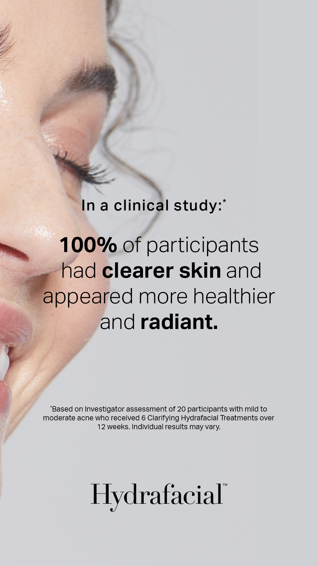 Express HydraFacial - quick results