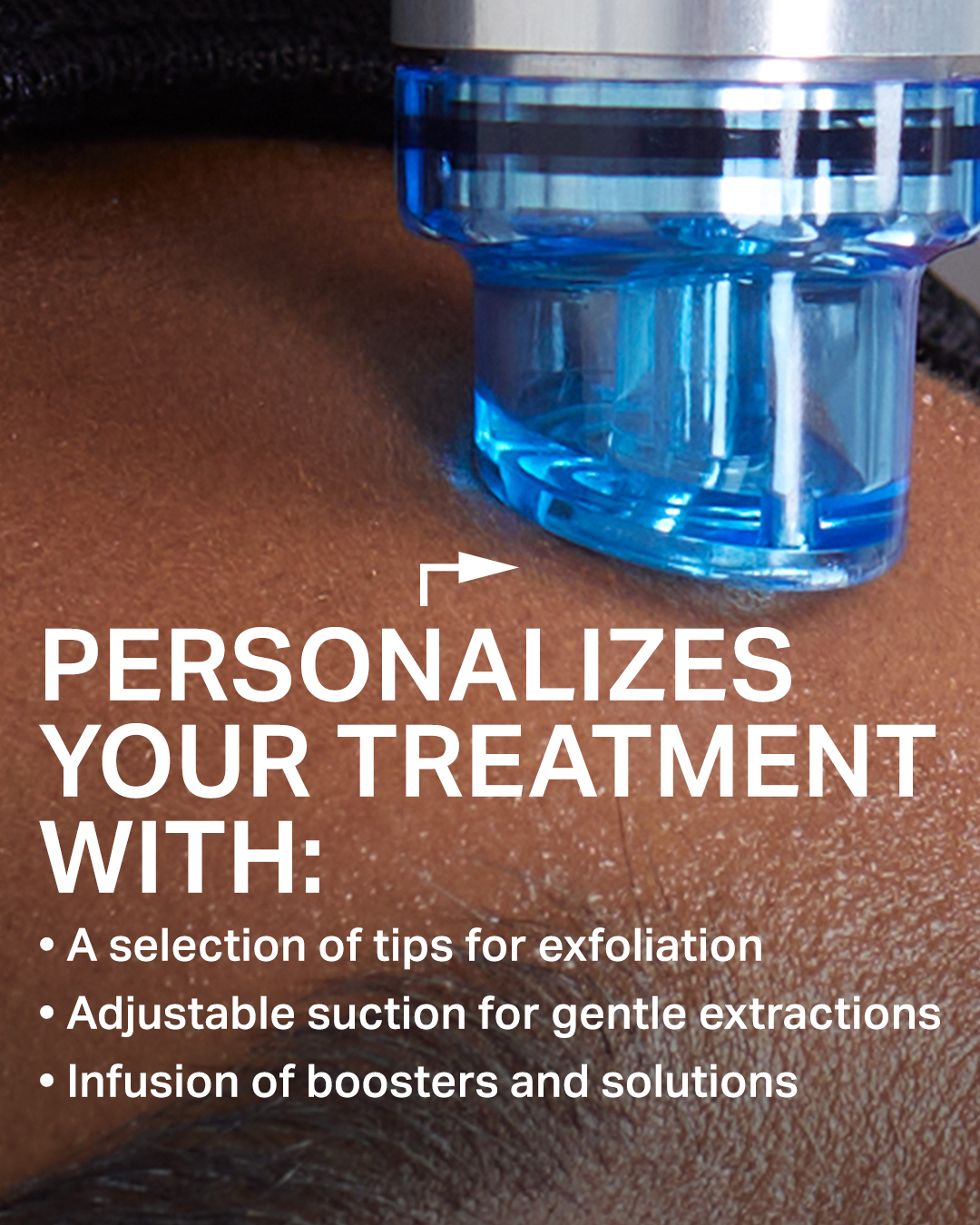 Ultimate HydraFacial treatment in Brea